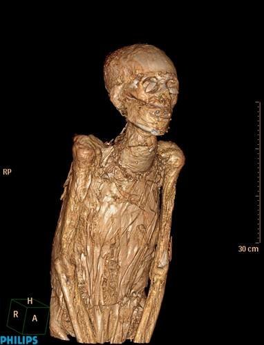 Meresamun in bandages - Photos: 3000 year old mummy seen using hi-tech ...