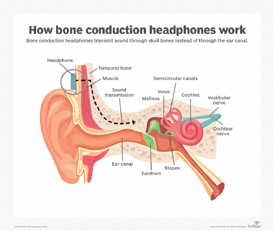 Diagrama de audio de conducción ósea